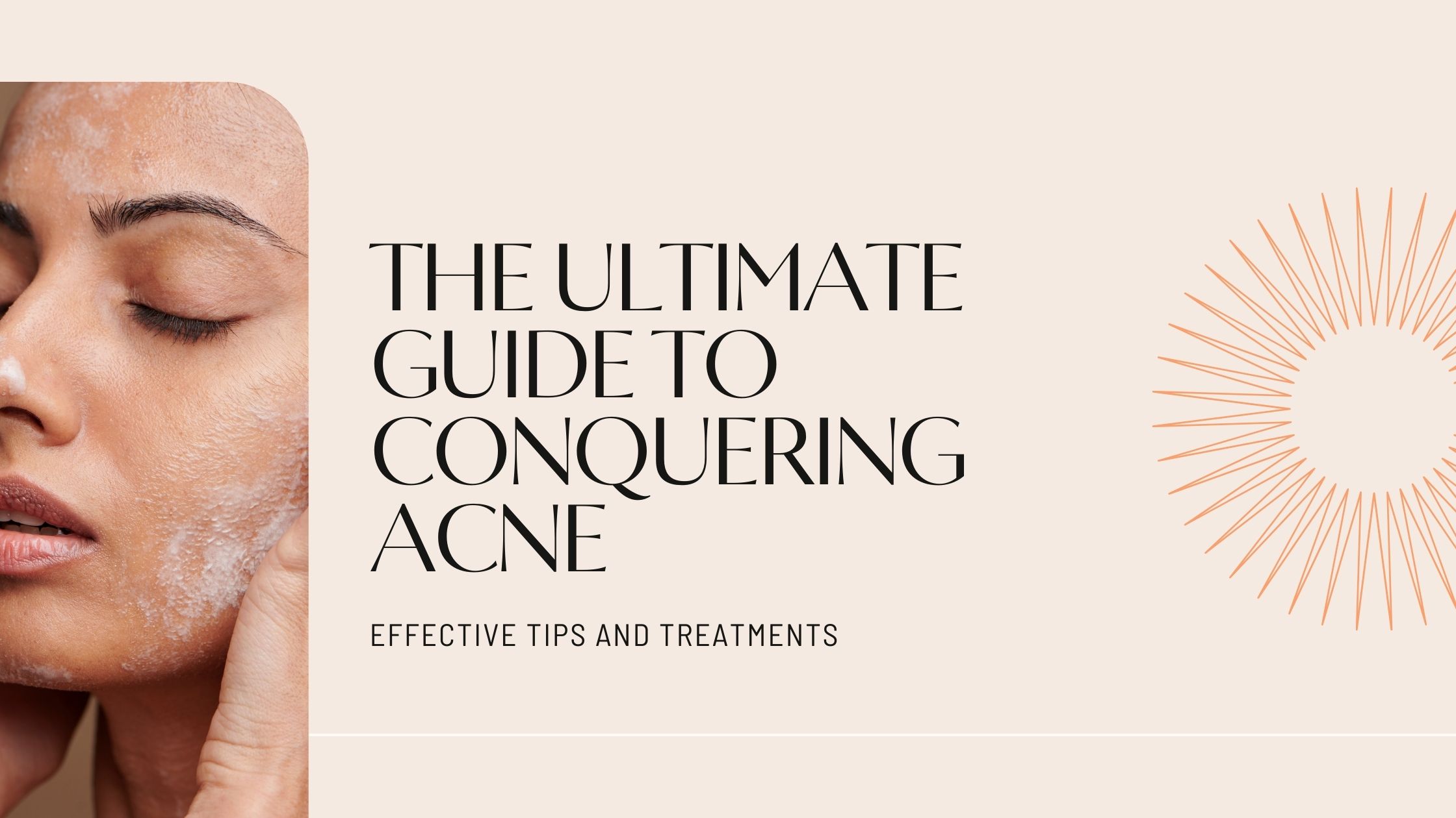 The Ultimate Guide to Conquering Acne: Effective Tips and Treatments 